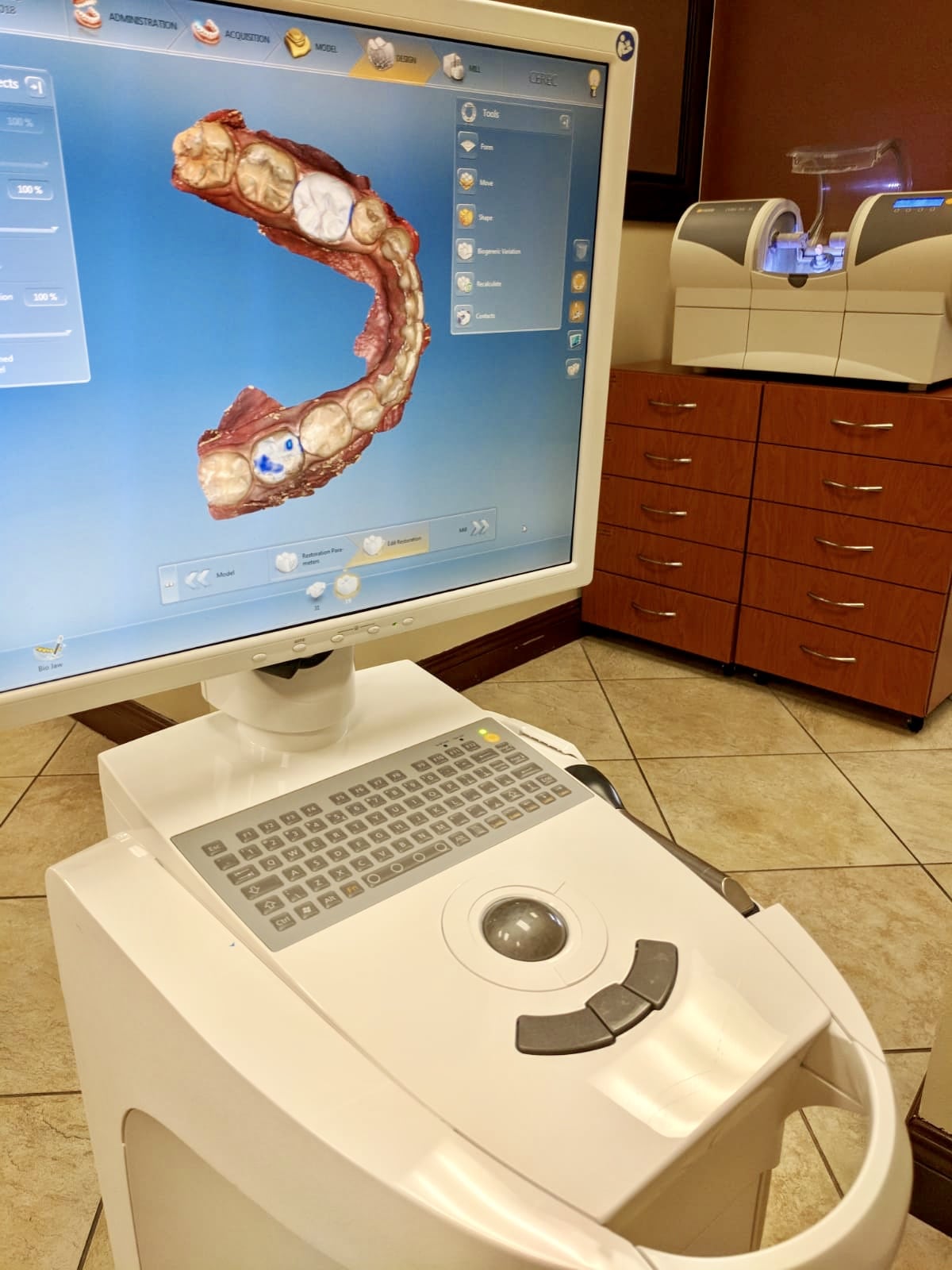 CEREC Latest Digital  Imaging   Tustin Dental  Center A 